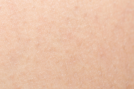 粗糙的皮肤图片