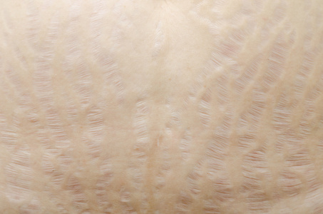 在女人肚皮上的妊娠纹照片