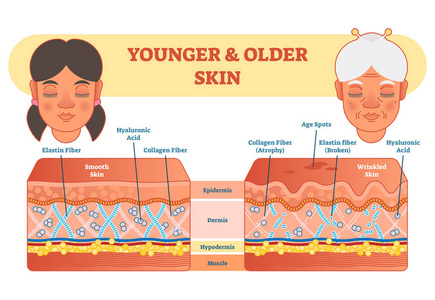 更老和更加年轻的皮肤比较图, 向量图解方案