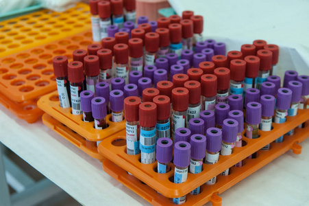 输液站试管中的血液样本照片