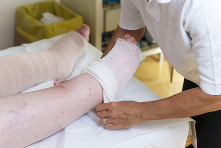 女人包扎病人的腿照片