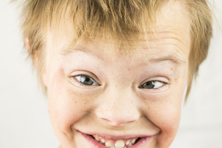 的脸唐氏综合征的爱几个孤立女孩和患有唐氏综合症的人的图片唐氏综合