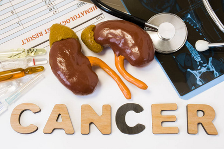 医学照片解剖：癌症风险肾上腺肿瘤磁共振成像转移因素