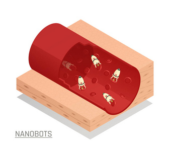 Nanorobots 血管等量成分