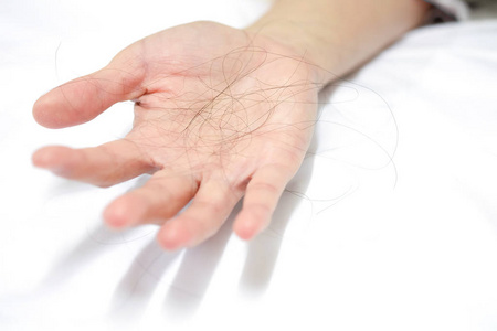 在白色背景的妇女手中的许多脱发照片