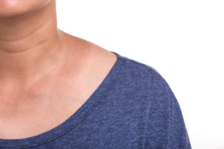 太阳紫外线图片