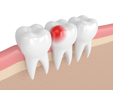 3d 牙龈牙痛的牙齿呈现