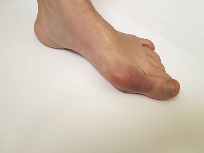 在白色背景上的外翻女性腿照片