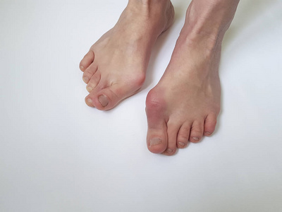 在白色背景上的外翻女性腿照片