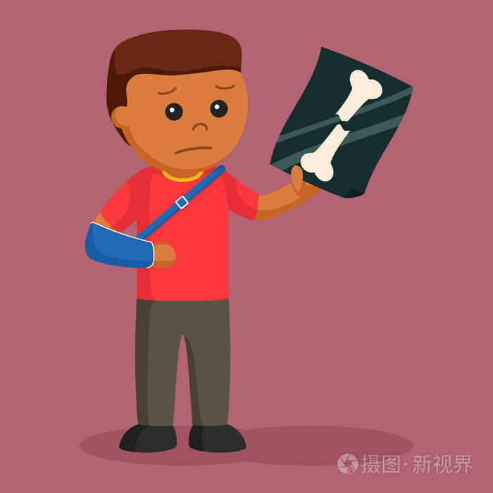 非洲男子手外伤和显示他的 x 线