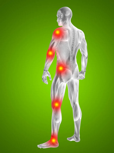 人类肌肉与关节或骨骼疼痛图片