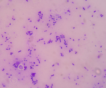 生命或死亡图片