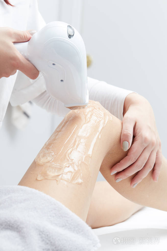 美容师脱毛激光治疗给在大腿上的女人