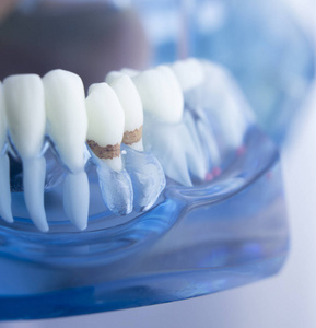 牙科牙齿牙科模型图片