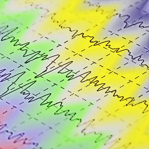 心形生命线图解脉搏低的病人,医学生命体征监测,心脏传感器诊断脑波对