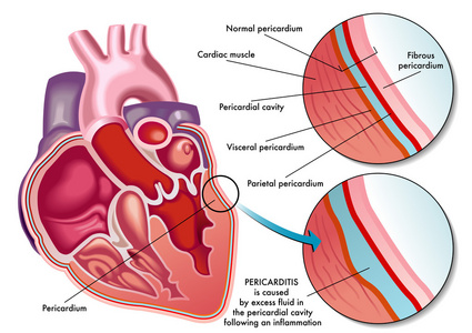 心包图片-心包素材-心包插画-摄图新视界
