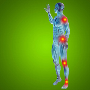 人类肌肉与关节或骨骼疼痛图片