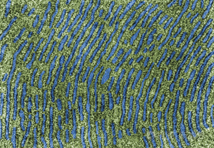 粗内质网.假彩色透射电镜