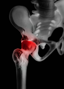 人髋关节与红色突出在痛苦区域x 射线影片医疗保健人体解剖和医学概念在黑色背景下隔离图片