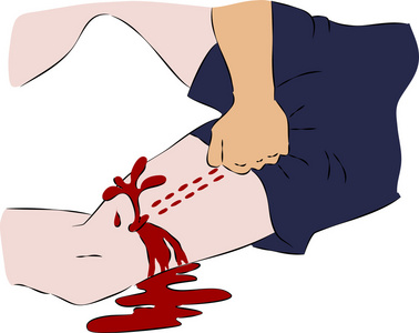 急救密切血流从腿上的伤口照片