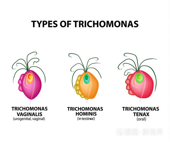 类型trichomonads肠口服阴道毛滴虫结构滴虫病泌尿生殖