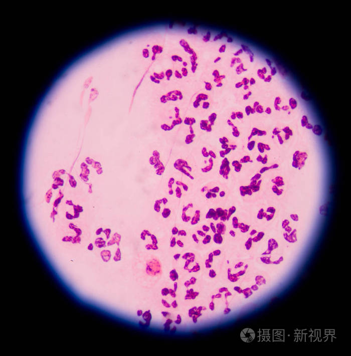 红血细胞显微镜在医学背景概念下