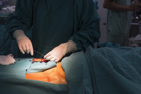 股穿刺股动脉在腹股沟,访问股动脉照片