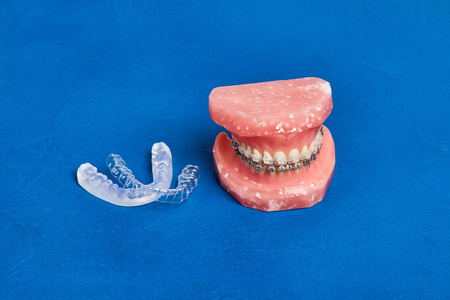 人类的下巴或牙齿模型金属有线的牙齿矫正