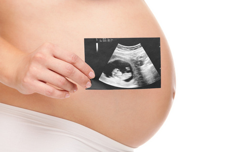 怀孕的妇女抱着一个超声扫描