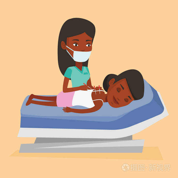 针灸医生制作针灸疗法