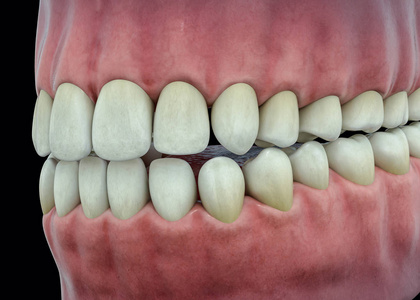 3d 孤立的牙齿。牙齿牙科护理概念