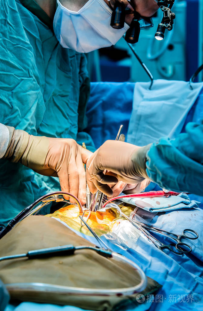 外科医生进行心脏手术