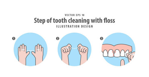 用牙线图解矢量在蓝 ba 上清洗牙的步骤照片