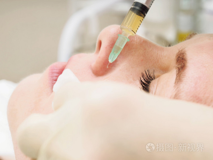 美容程序 mesoteraphy.复兴振兴,皮肤营养,减少皱纹.医生制作微针注射