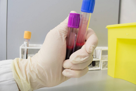 验血仪器gif图片