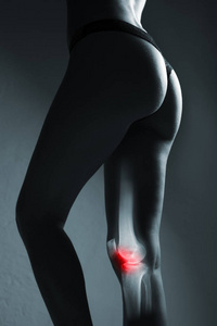 人膝关节和腿在 x射线, 在灰色背景