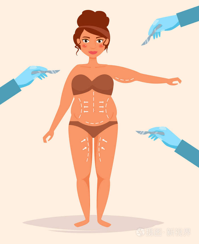 整形手术载体.卡通