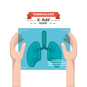 Tubereculosis 概念设计