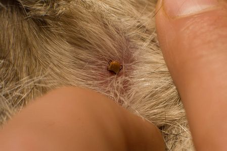 蜱虫被禁止的符号婴儿狒狒和妈妈一起玩产妇护理猕猴小狒狒和妈妈玩