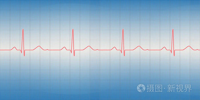 矢量图的蓝色背景上的正常心电图