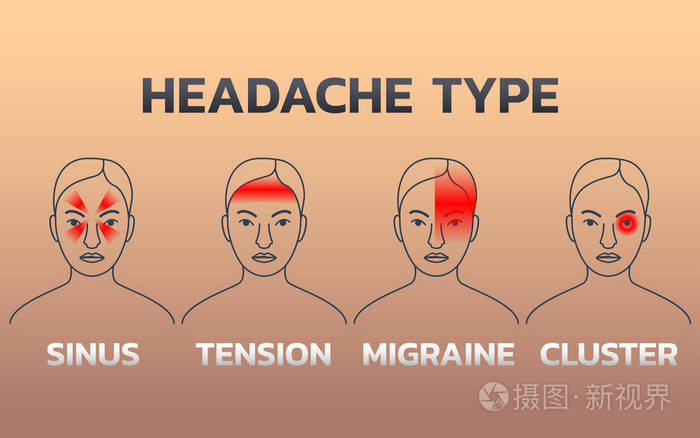 头痛的类型图表设计模板, 图标矢量不适
