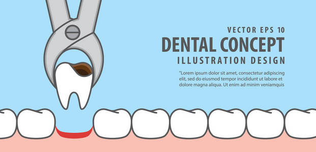 在蓝色背景上的横幅牙齿去除例证载体。书房
