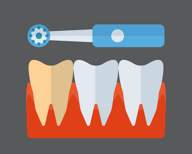 牙齿刷和植入的矢量图标
