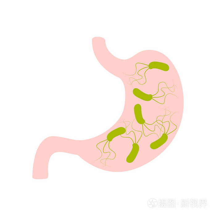 幽门螺杆菌手绘红蓝图片