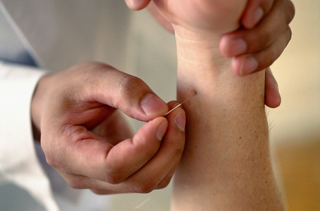 中医针炙铜人像图片