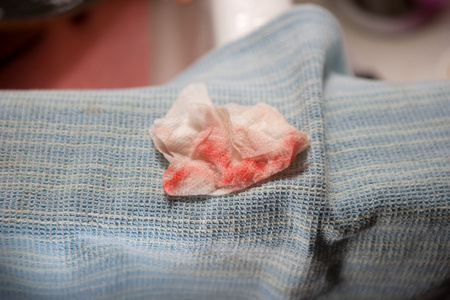 纸巾上有血图片