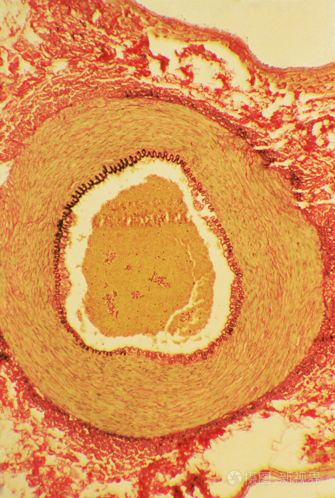 显微镜下的血管
