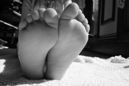 脚底纤维瘤图片