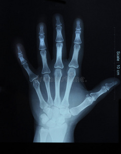 当归片图片-当归片素材-当归片插画-摄图新视界