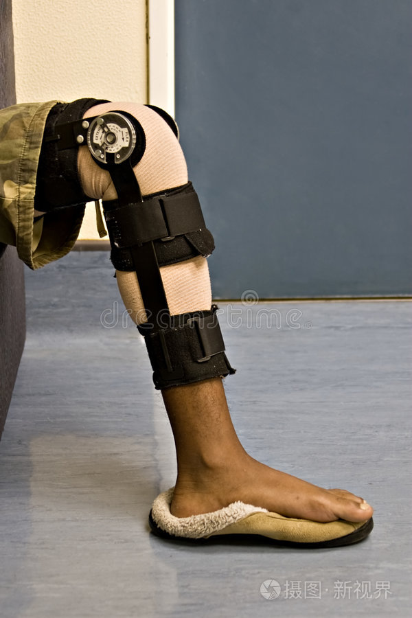 石膏绷带病人儿科医生检查女孩断腿伤心的病人痛苦中的人断腿住院的